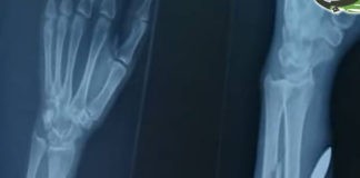 إصابة امرأة بطلق ناري راجع في مدينة جبلة