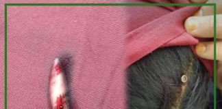 رصاص مجهول الهوية