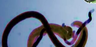 حملة للتخلص من البلهارسيا في محافظة إب