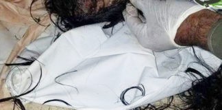 الكشف عن غموض موت الطفلة علياء بإب