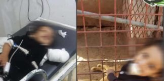 طفلة تفقد يدها اليسرى بين فكي أحد أسود حديقة الحيوان بإب