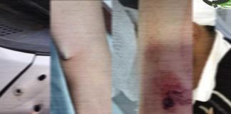 وفاة طفلة وإصابة خمسة أخرين جراء سقوط الرصاص الراجع مساء الأمس