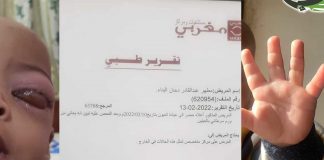 تعاطف كبير حيال إصابة نجل الشاعر عبدالقادر البناء بمرض السرطان