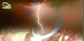 وفاة مواطن إثر صاعقة رعدية في مديرية السدة بإب