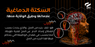 #انفوجرافيك : السكتة الدماغية